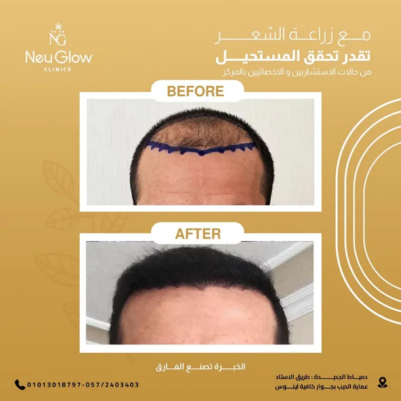 Deltaderm Clinic
