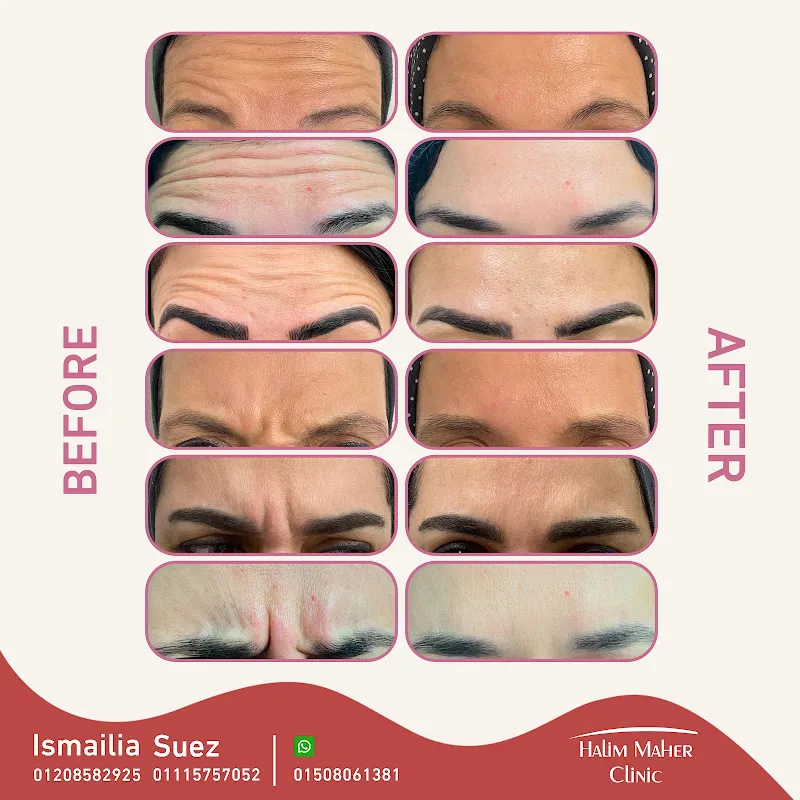 دكتور حليم ماهر (جلدية - تجميل - امراض ذكورة) DR Halim Maher Clinic