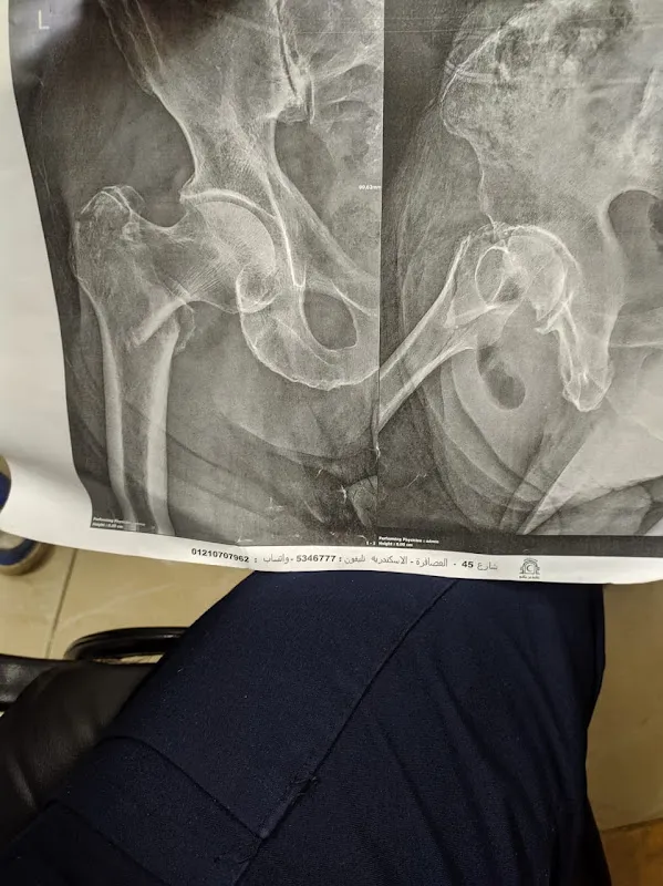 Dr. Hossam El-Din Ali Abou Arab - Consultant in General Surgery, Fractures, Joint Replacements, Sports Injuries, and Pediatric Orthopedic Deformities