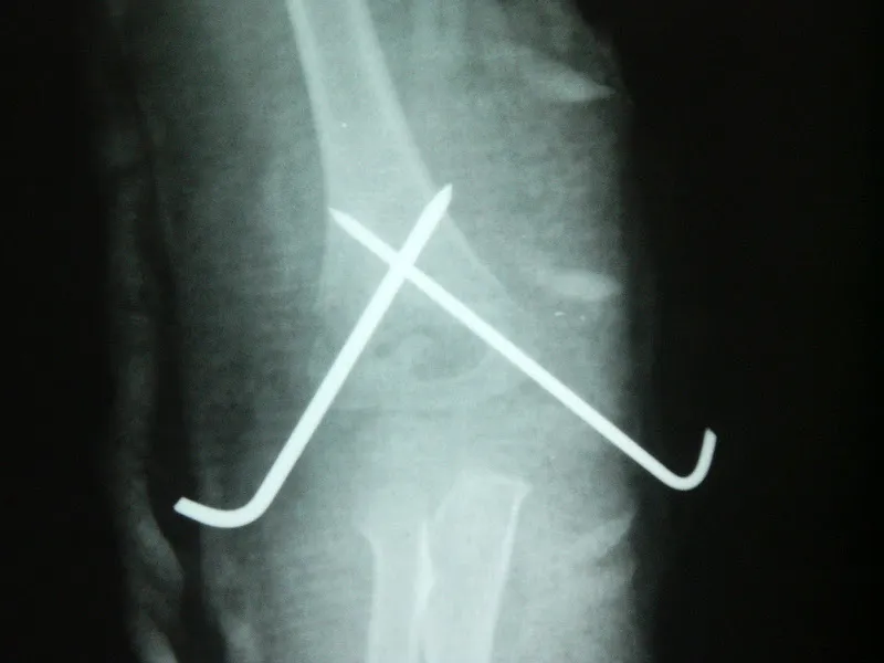 Orthopaedic Clinic (Dr.Ibrahim El-Sherbiny)