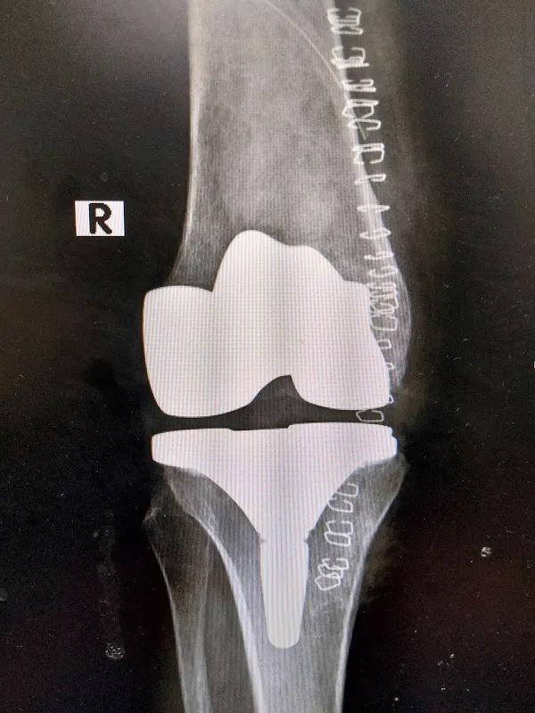Gergis orthopedic