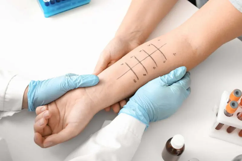 Medical Allergy and Immunology Clinic