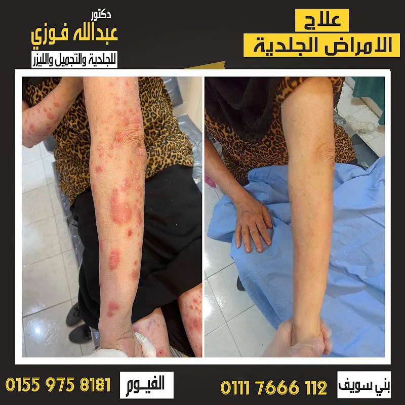 عياده د.عبدالله فوزي للجلدية والتجميل والليزر
