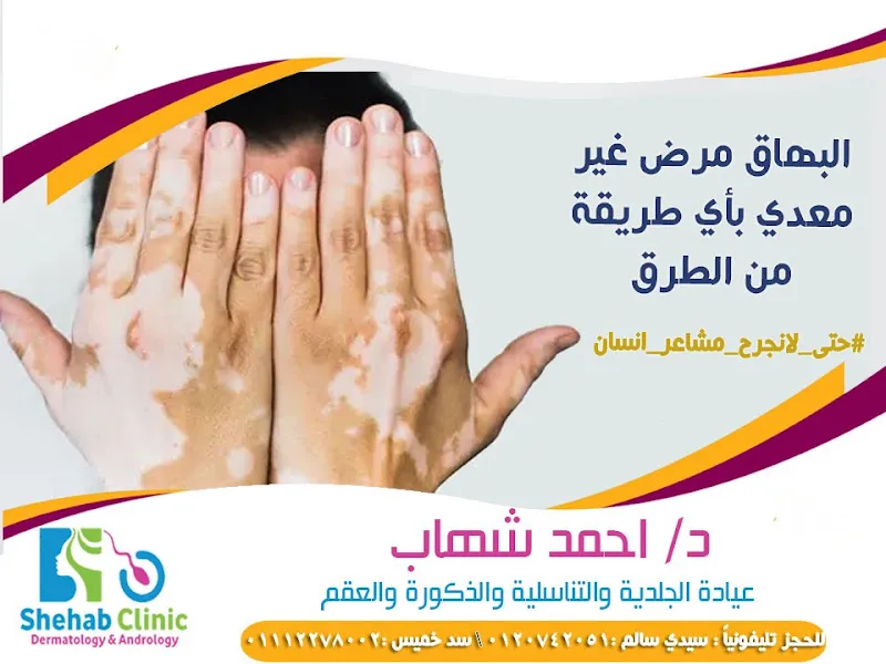 Dr. Elawady Eye Clinic