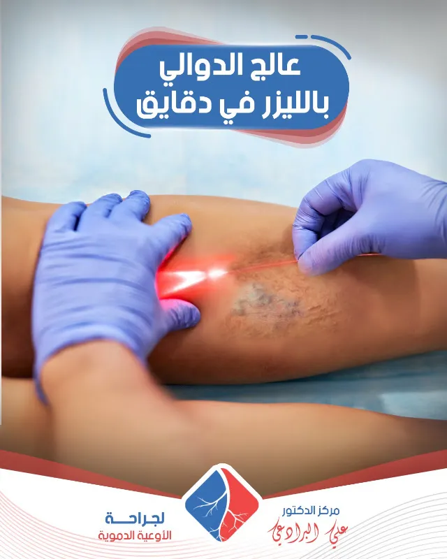 دكتور علي البرادعي لجراحة الأوعية الدموية والقسطرة الطرفية والقدم السكري