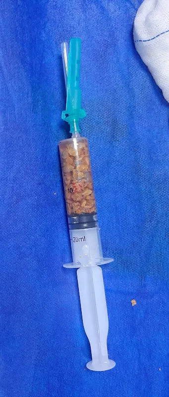 عيادة دكتور محمد فتحى النمر جراحة ومناظير المسالك البولية