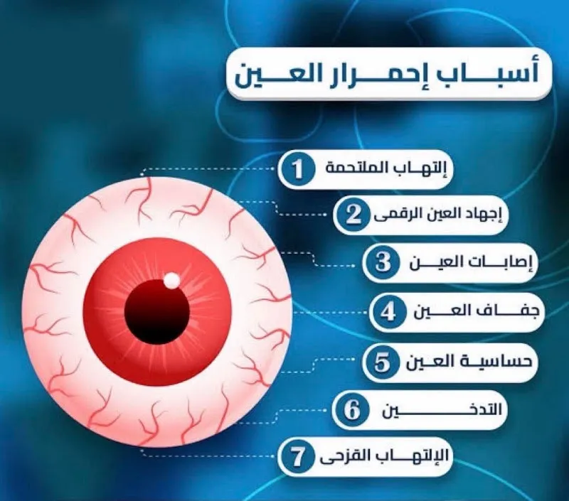 عيادة دكتورة فاطمه غلوش للعيون وتصحيح الابصار